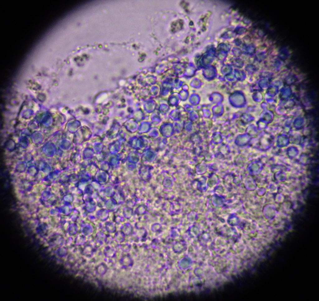 マラセチア酵母形顕微鏡像